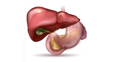 What Are Gallstones