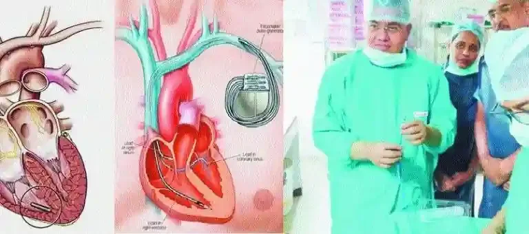 82-year-old man first from Central India to get pacemaker implanted