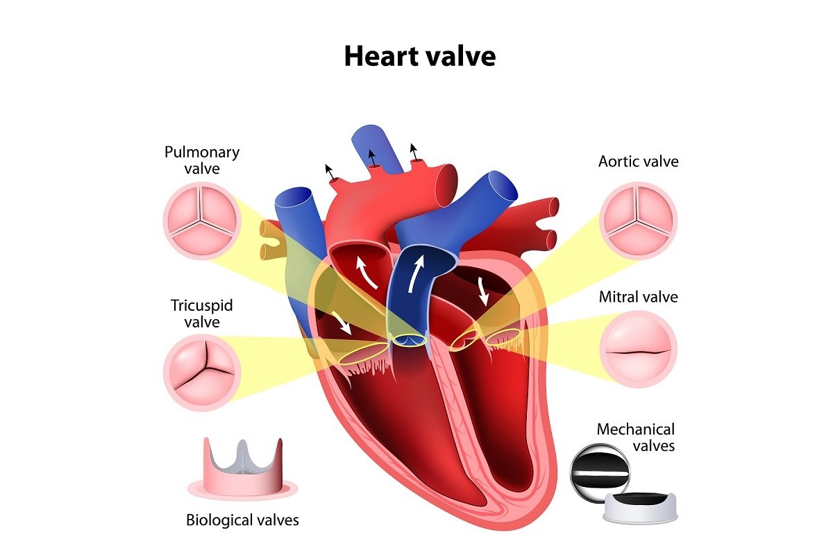 Heart Valve Surgery: Repair & Replacement