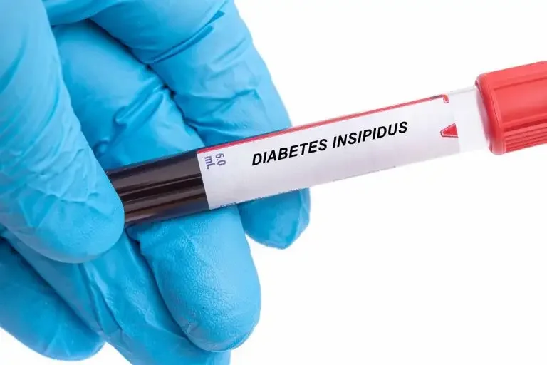 Diabetes Insipidus: Symptoms, Diagnosis & Treatment